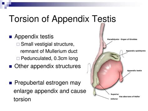 torsion appendix testis